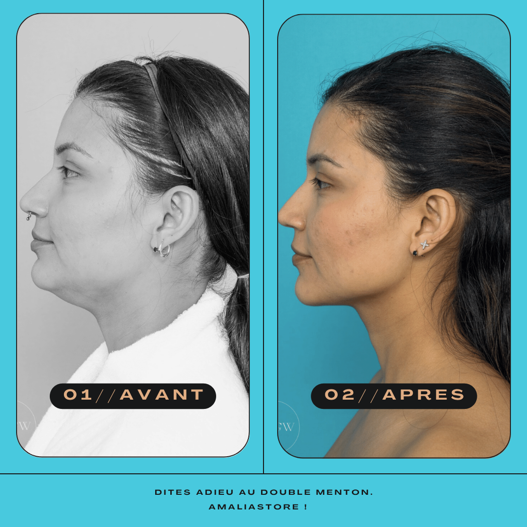 Amalia LiftUp – Bande Double Menton