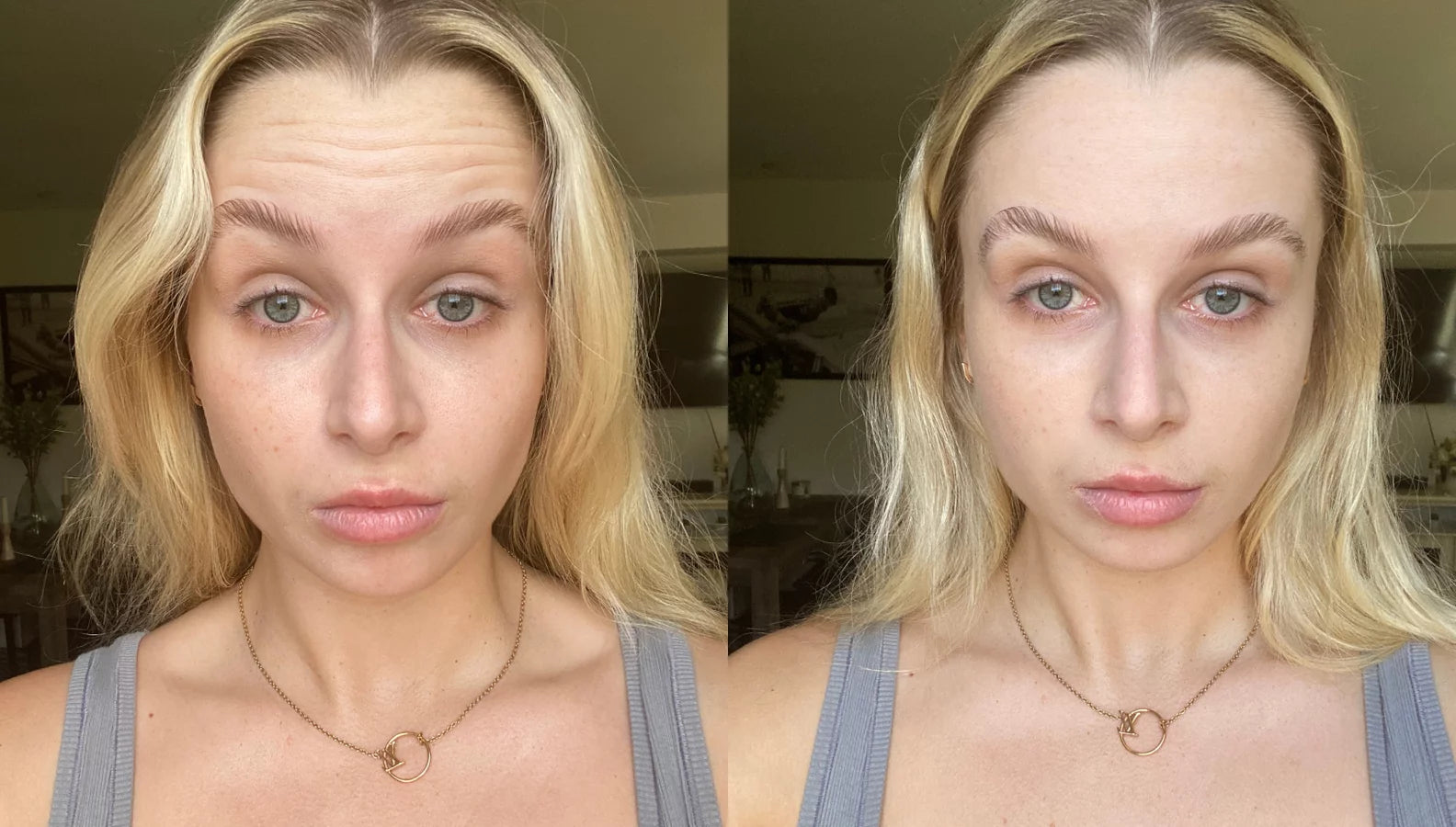 Sculpteur visage LED 7-en-1 Amalia